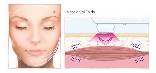 MLAY RF01  Desktop RF Beauty Device