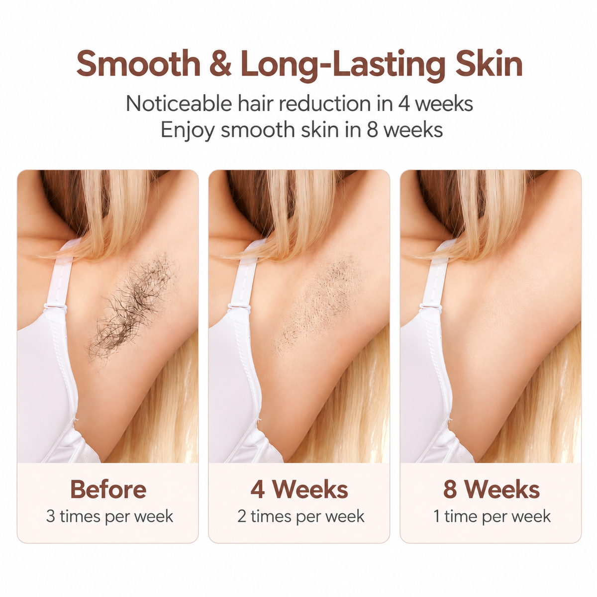 MLAY T11 IPL Hair Removal Device