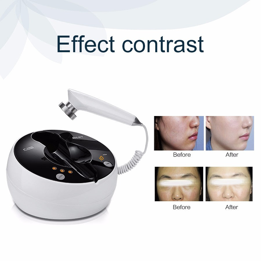 MLAY RF01  Desktop RF Beauty Device