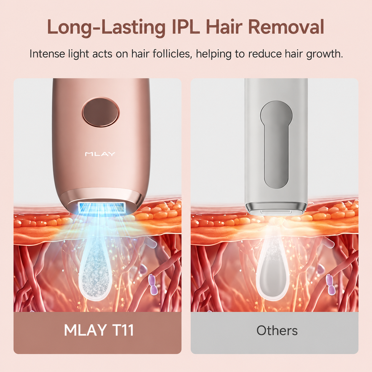 MLAY T11 IPL Hair Removal Device