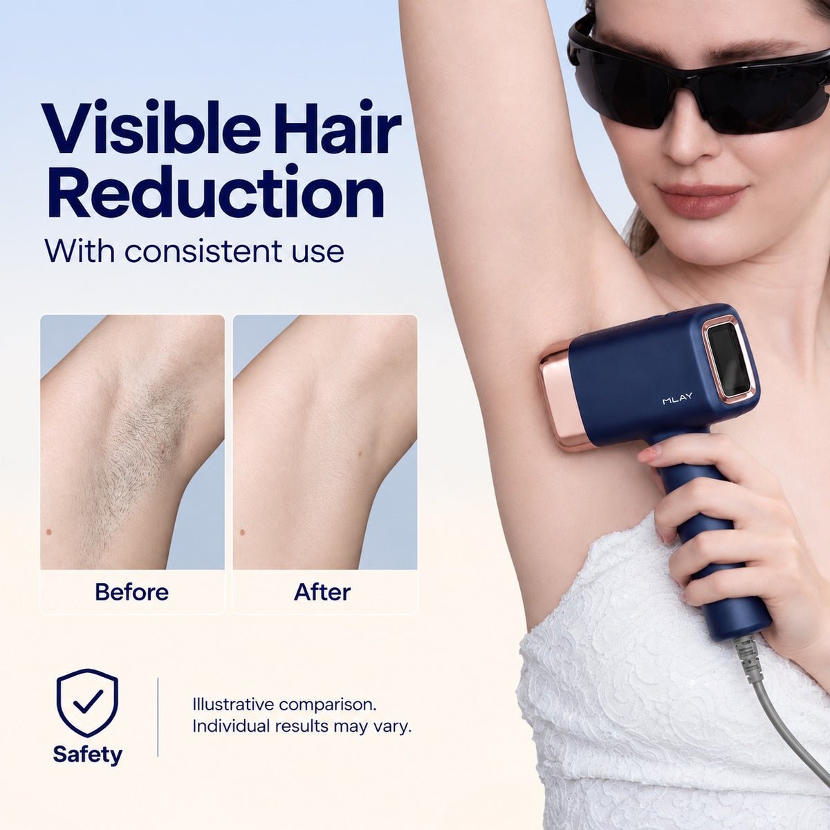 MLAY T14A IPL Hair Removal Deivice