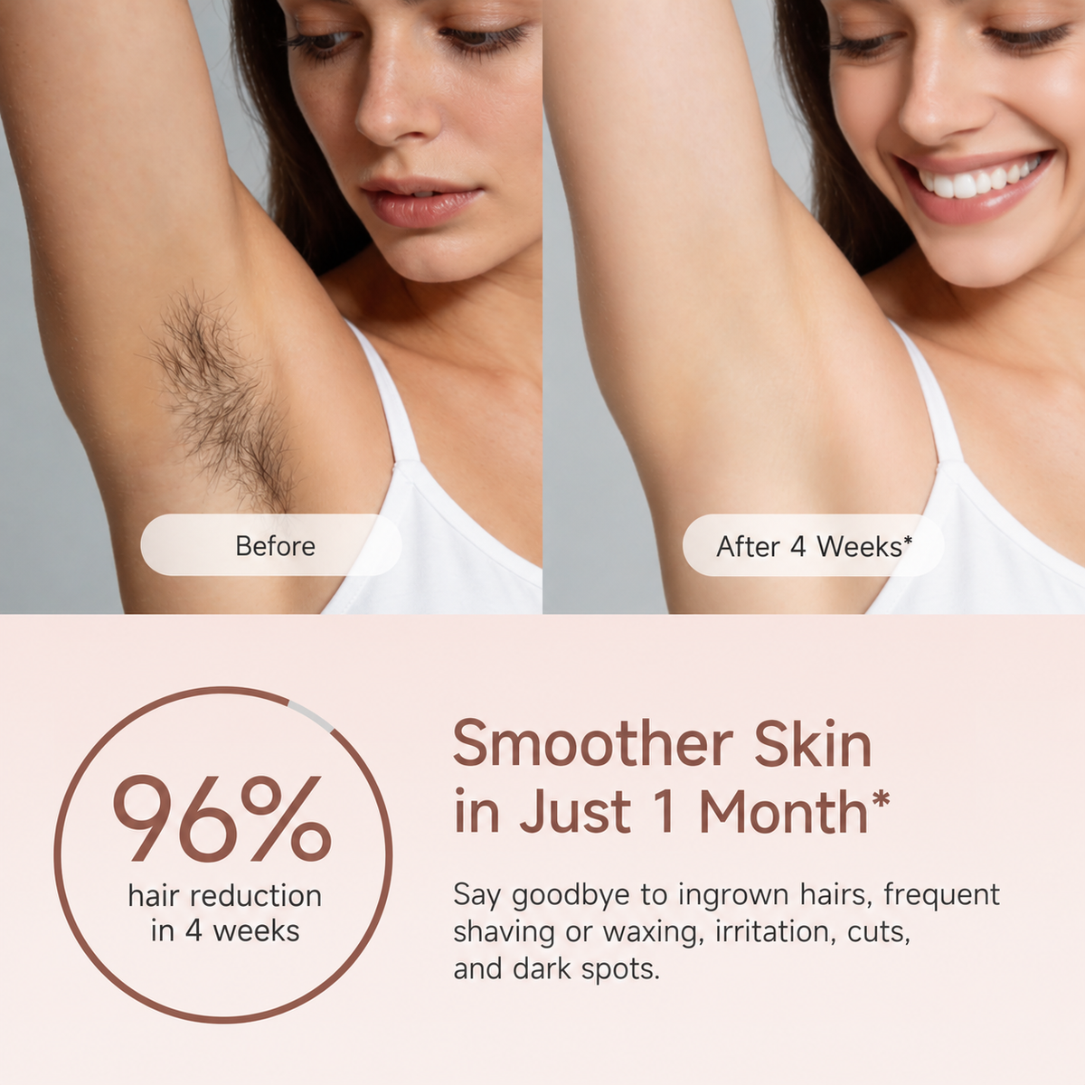 MLAY T11 IPL Hair Removal Device