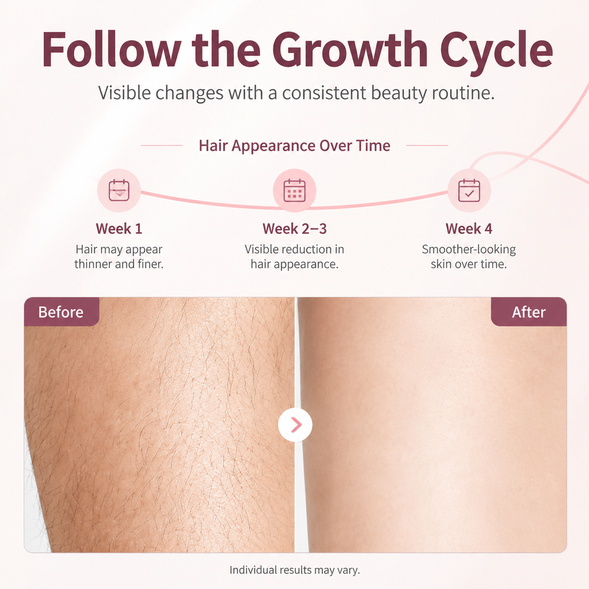 MLAY T4 IPL Hair Removal Device